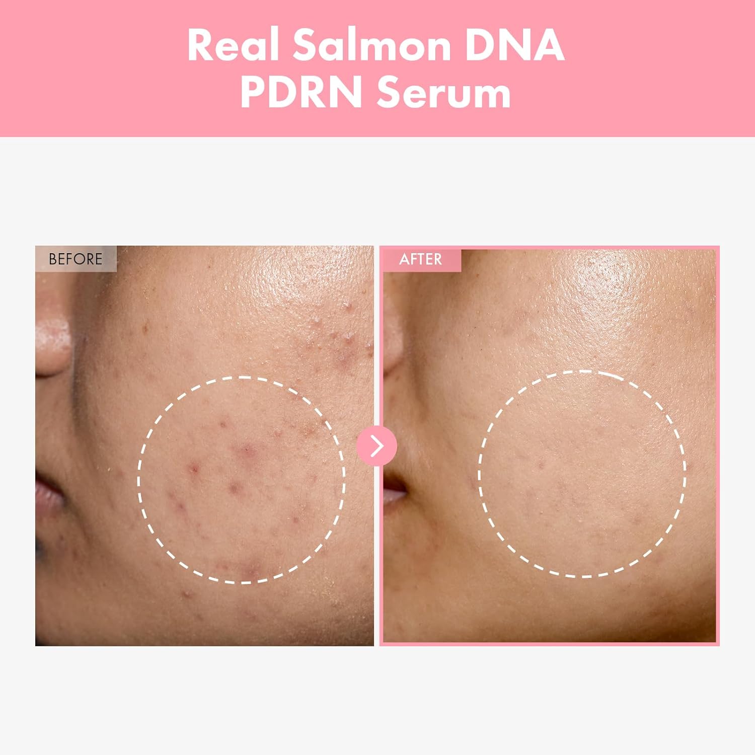 TOSOWOONG Pink Peptide 12 PDRN Serum With Salmon DNA PDRN 10,320ppm, 12 Peptides, Niacinamide, Skin glow, Hydrating, Moisturizing, Firming, Uneven Skin Tone, Korean Skincare, 33ml, 1.11 fl.oz